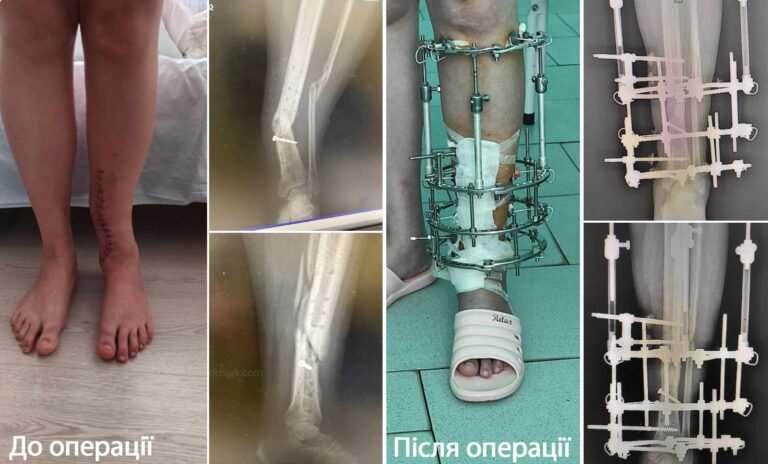 Фото до відгуку пацієнта